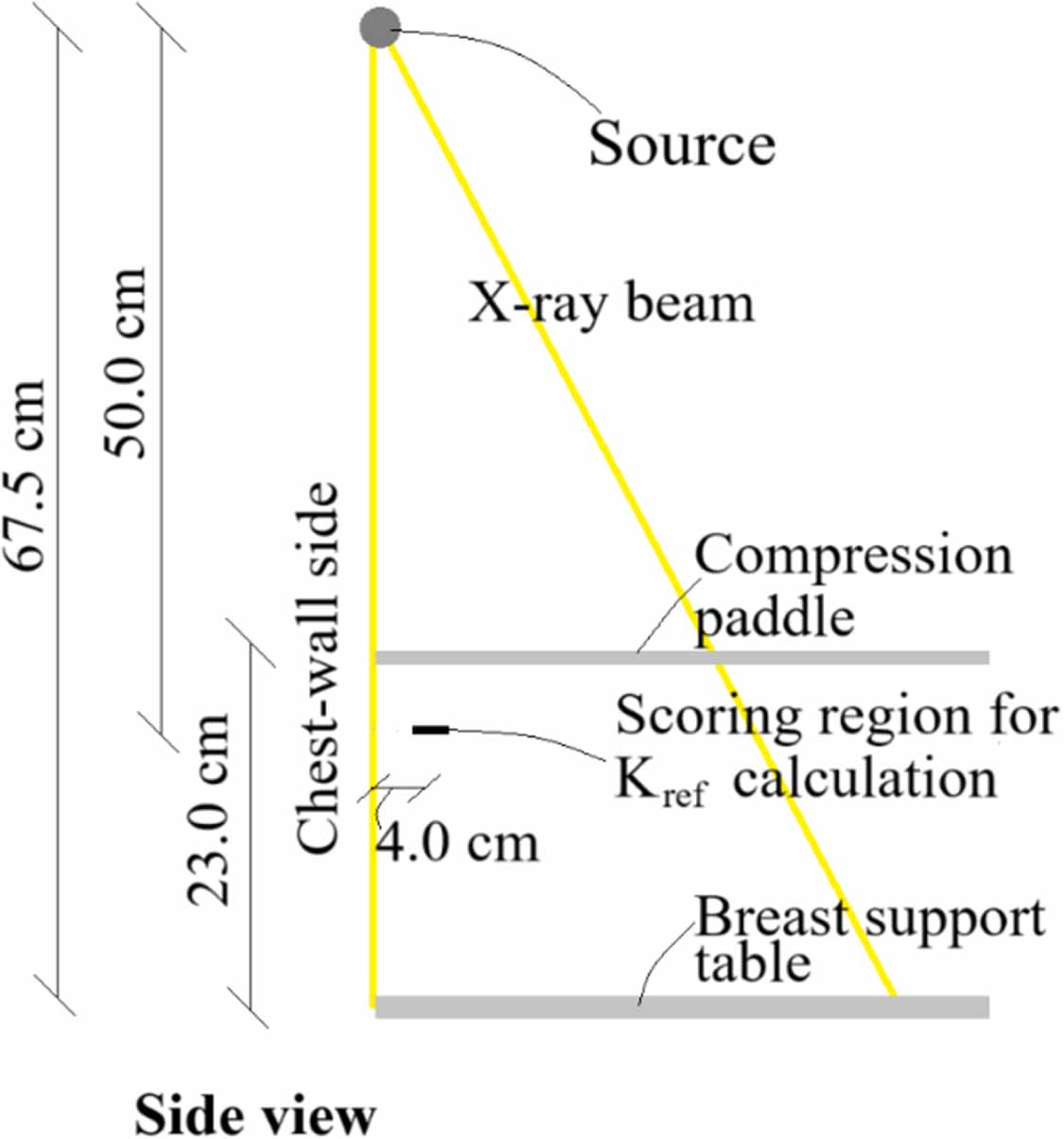 Average glandular dose prediction for breast model with patient ...
