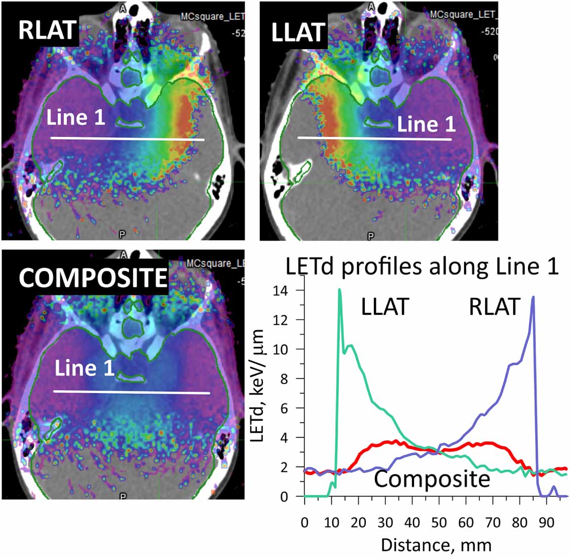Modified Ellison Let Reducing pitfalls in composite plan evaluations of dose-weighted linear ...