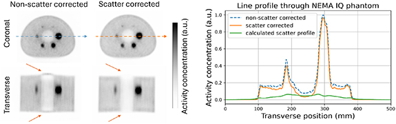 Monte Carlo-based scatter correction for the plastic-based modular PET ...