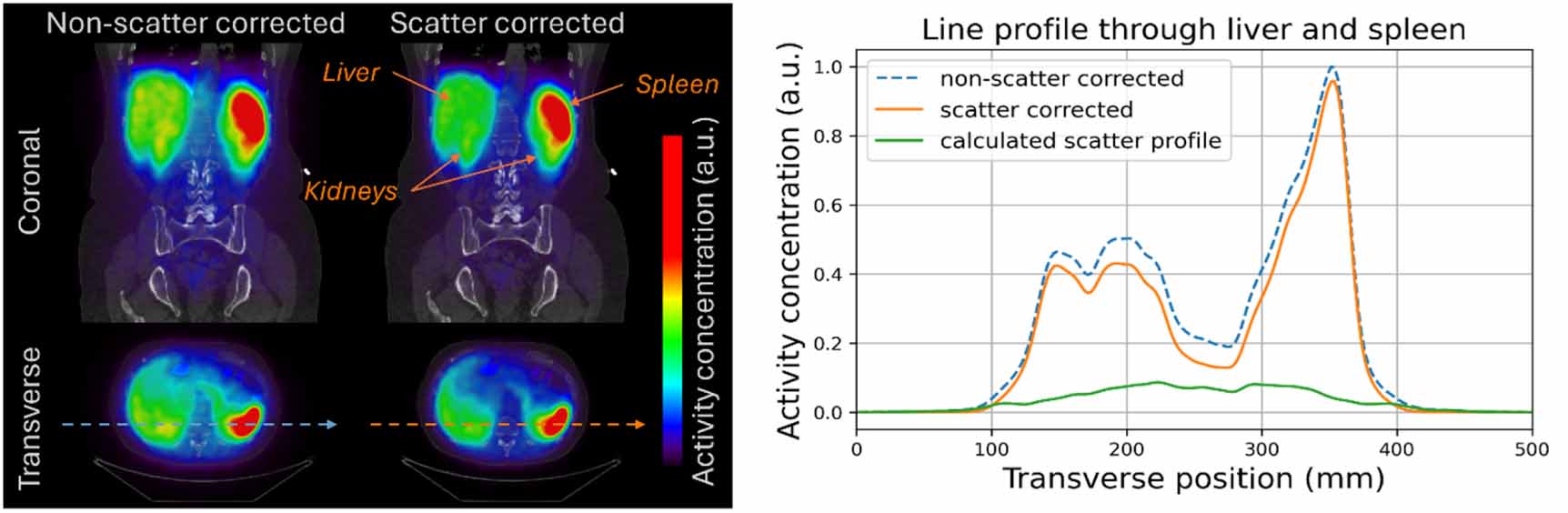 Monte Carlo-based scatter correction for the plastic-based modular PET ...