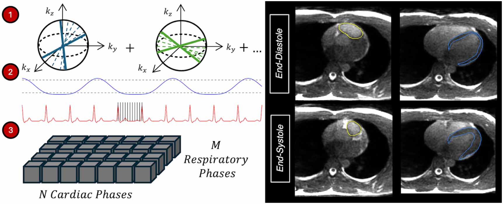 Deducing cardiorespiratory motion of cardiac substructures using a ...