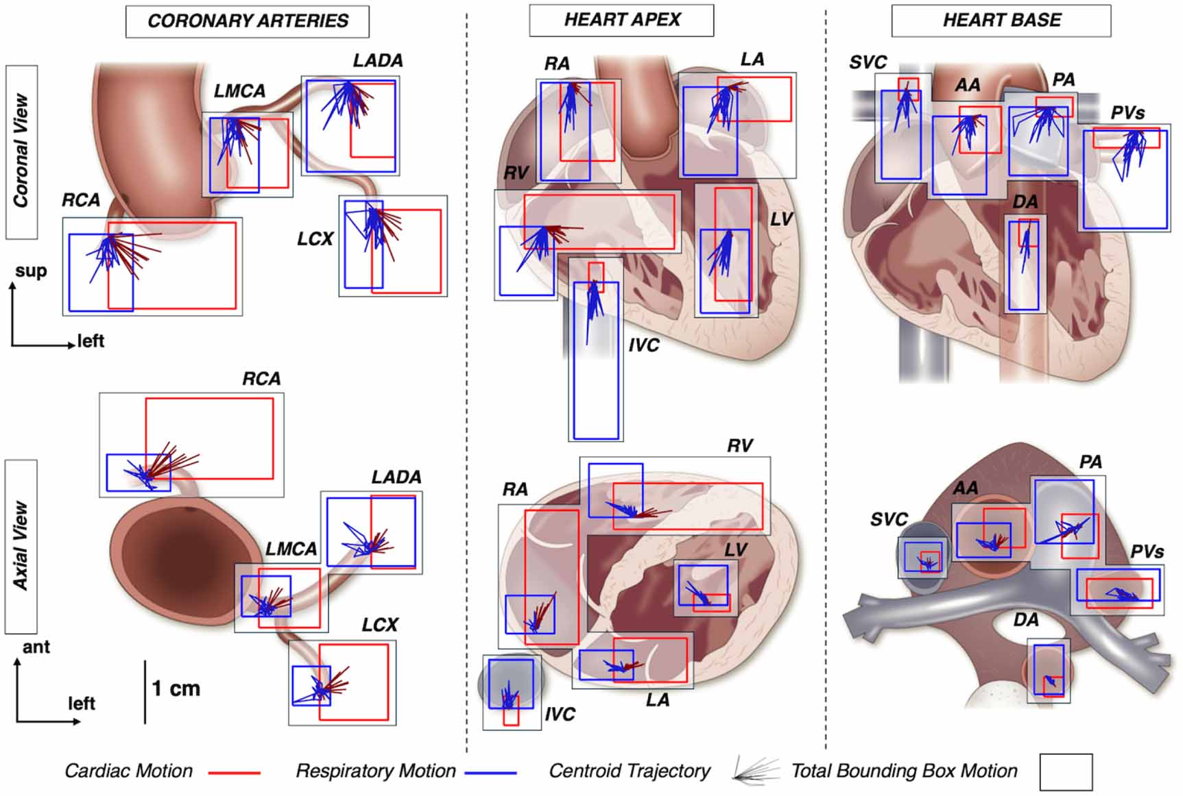 Deducing cardiorespiratory motion of cardiac substructures using a ...