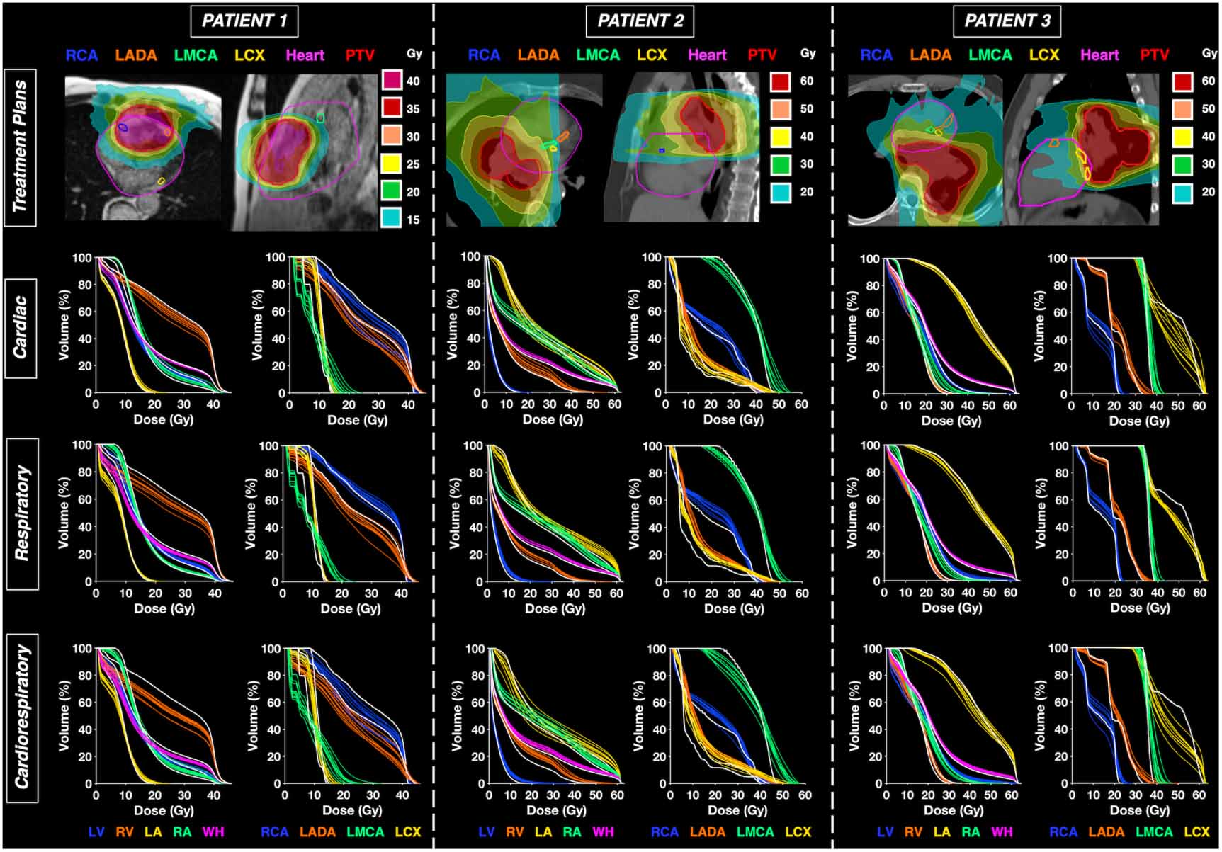 Deducing cardiorespiratory motion of cardiac substructures using a ...