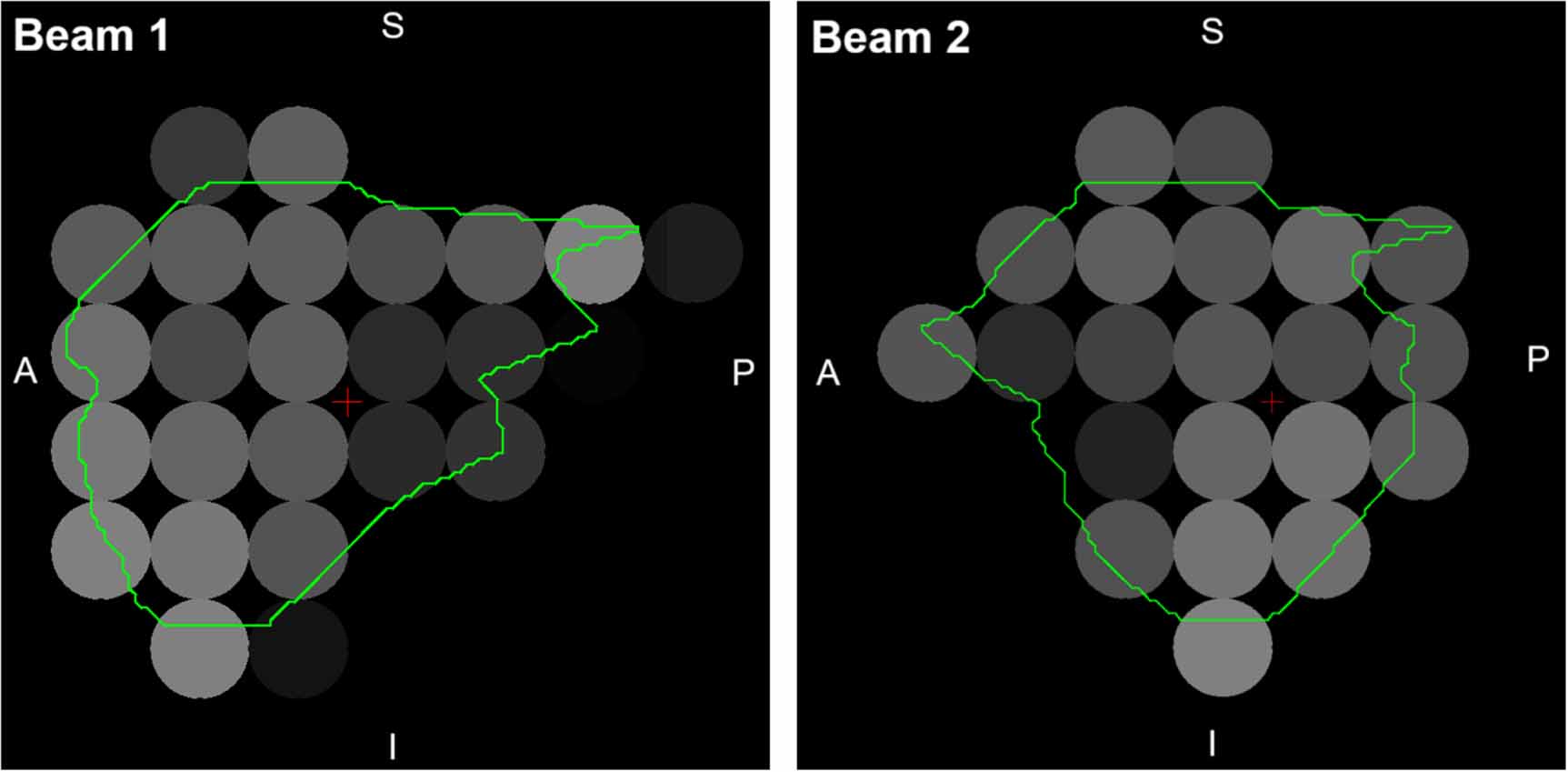 A beam model and Boltzmann solver for radiotherapy treatment planning ...