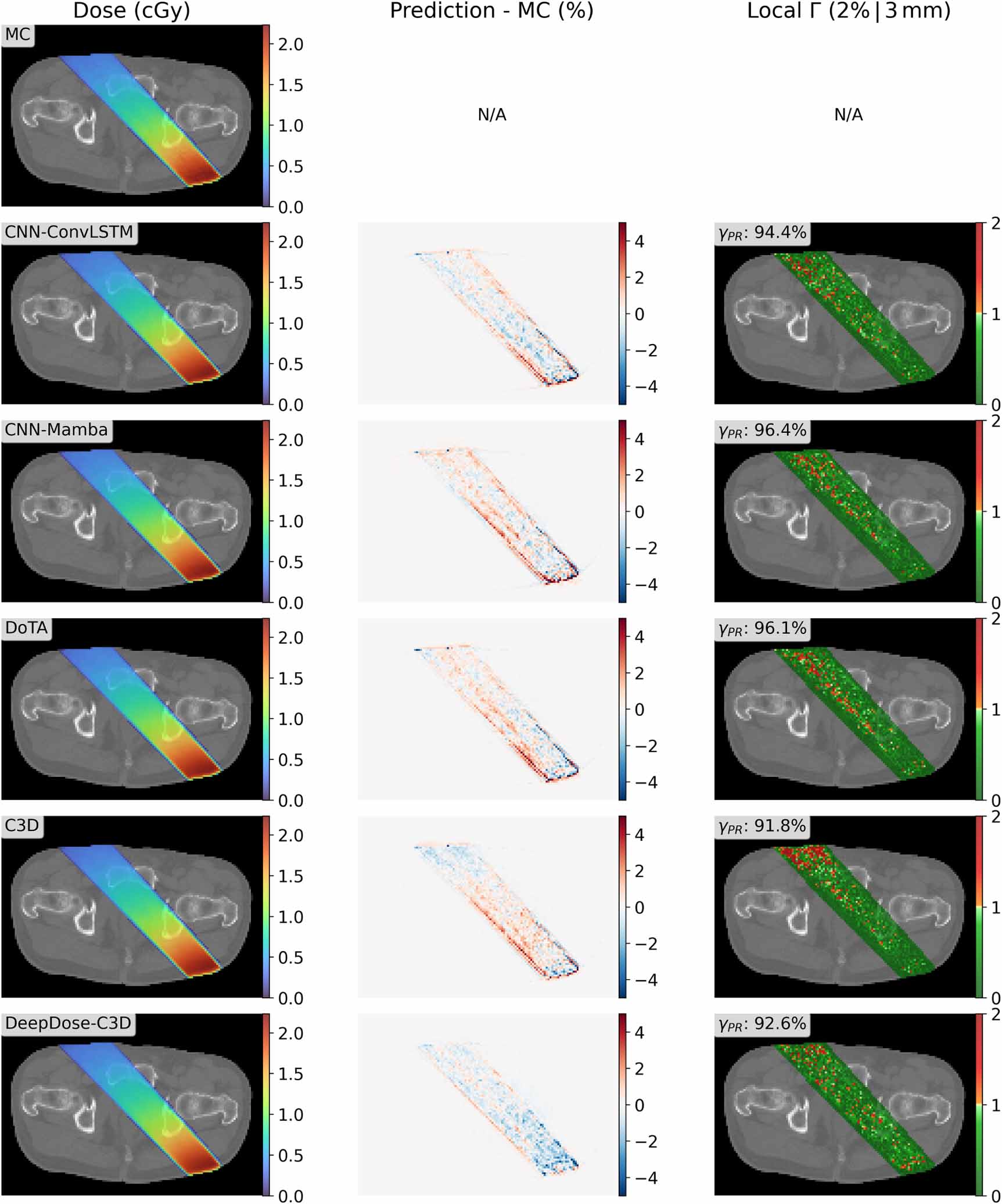 Multi-model study of fast VMAT segment dose calculation with deep ...