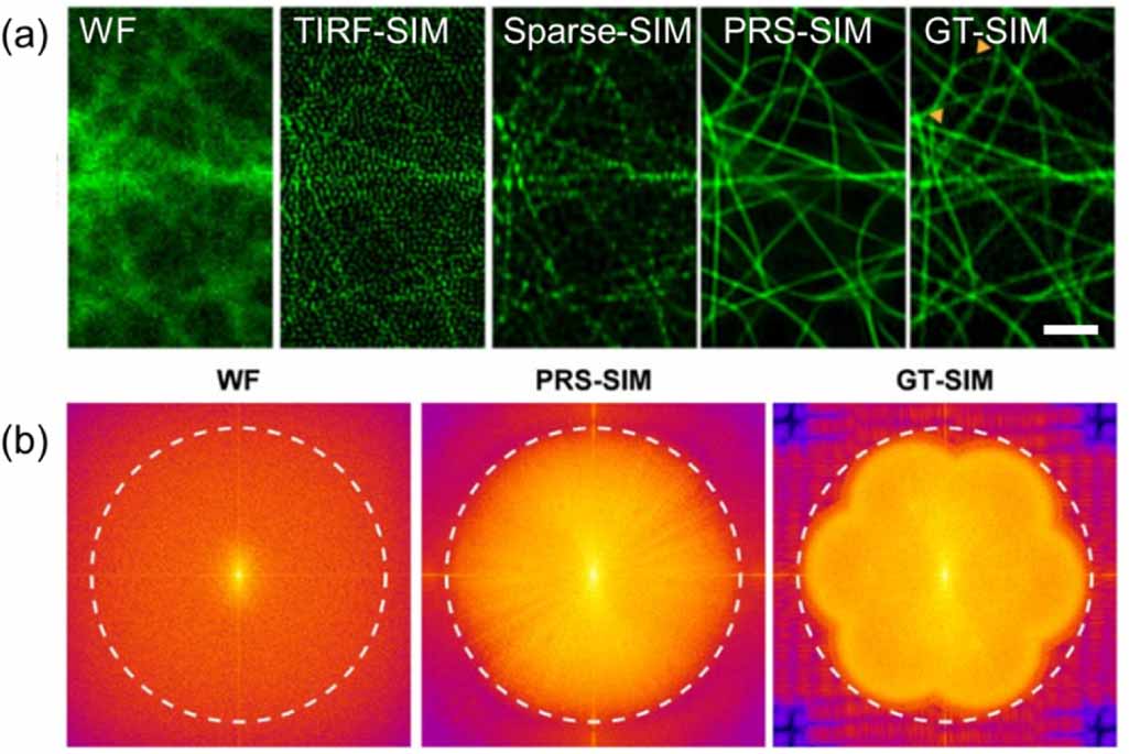 Real-time super-resolution structured illumination microscopy: current ...
