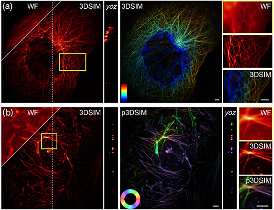 Real-time super-resolution structured illumination microscopy: current ...