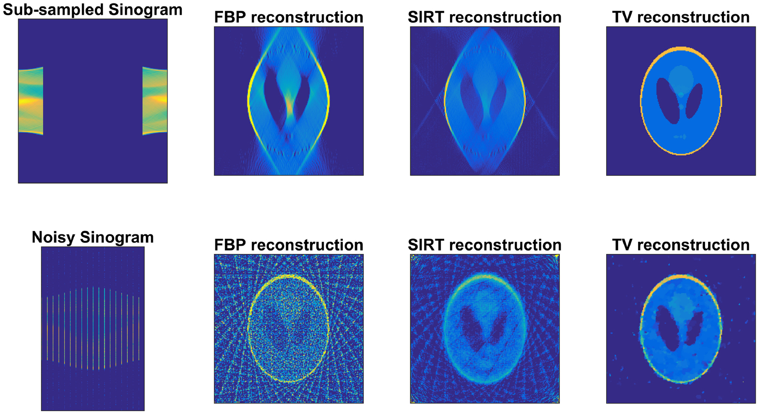 Directional sinogram inpainting for limited angle tomography - IOPscience