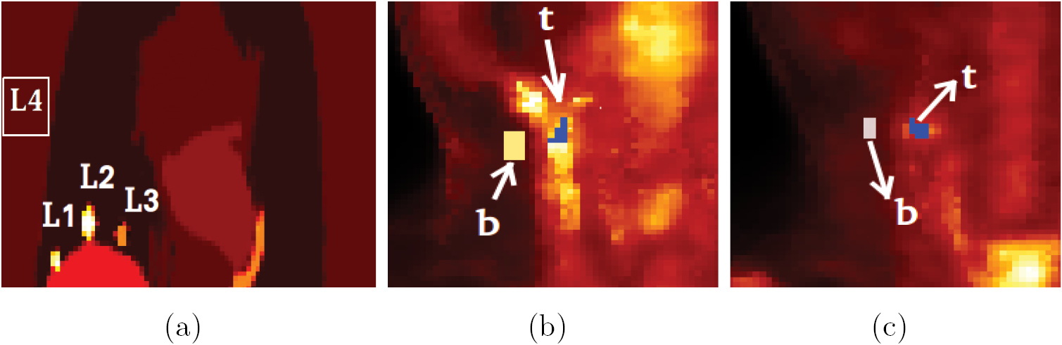 Hybrid PET-MR list-mode kernelized expectation maximization ...