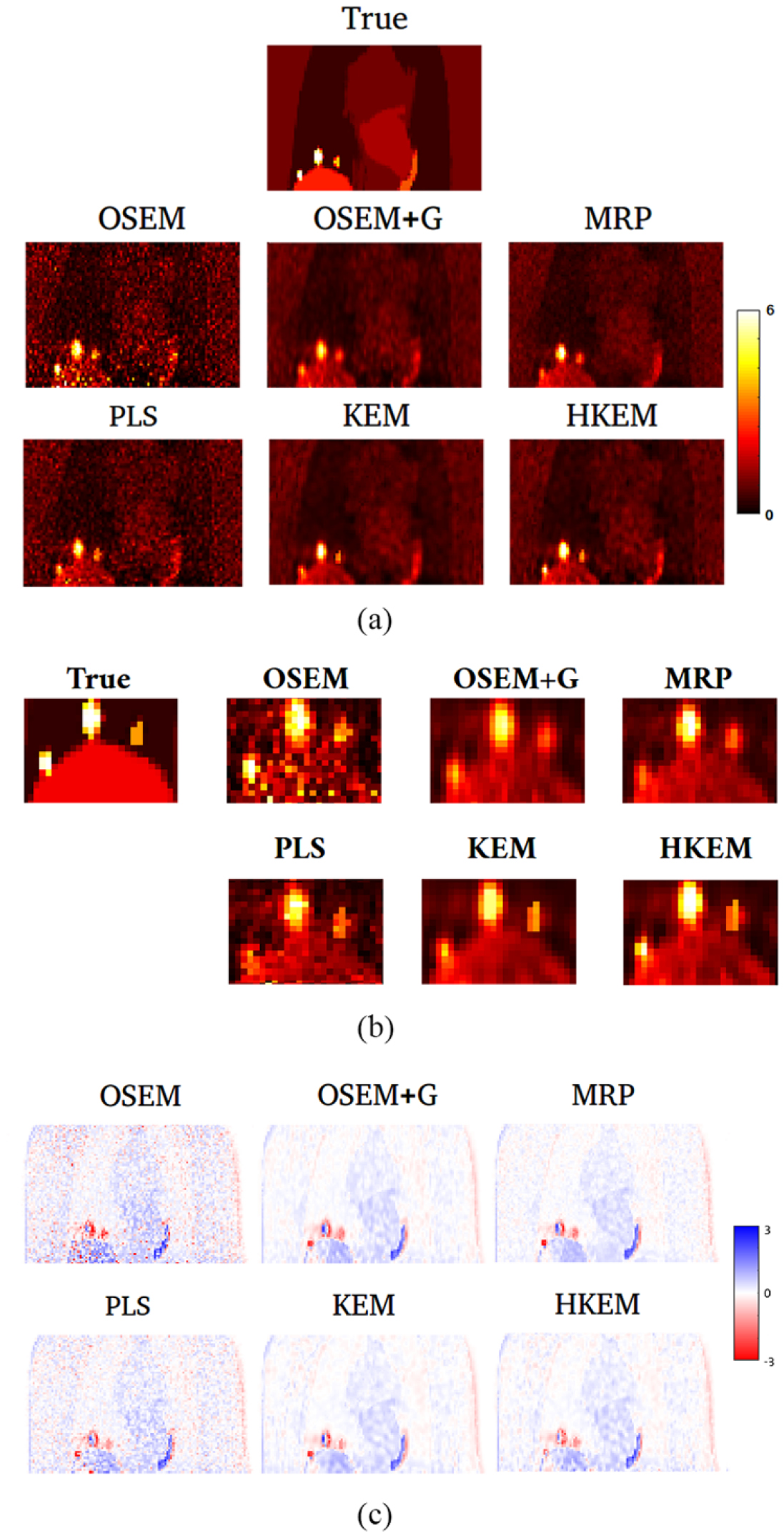 Hybrid PET-MR list-mode kernelized expectation maximization ...