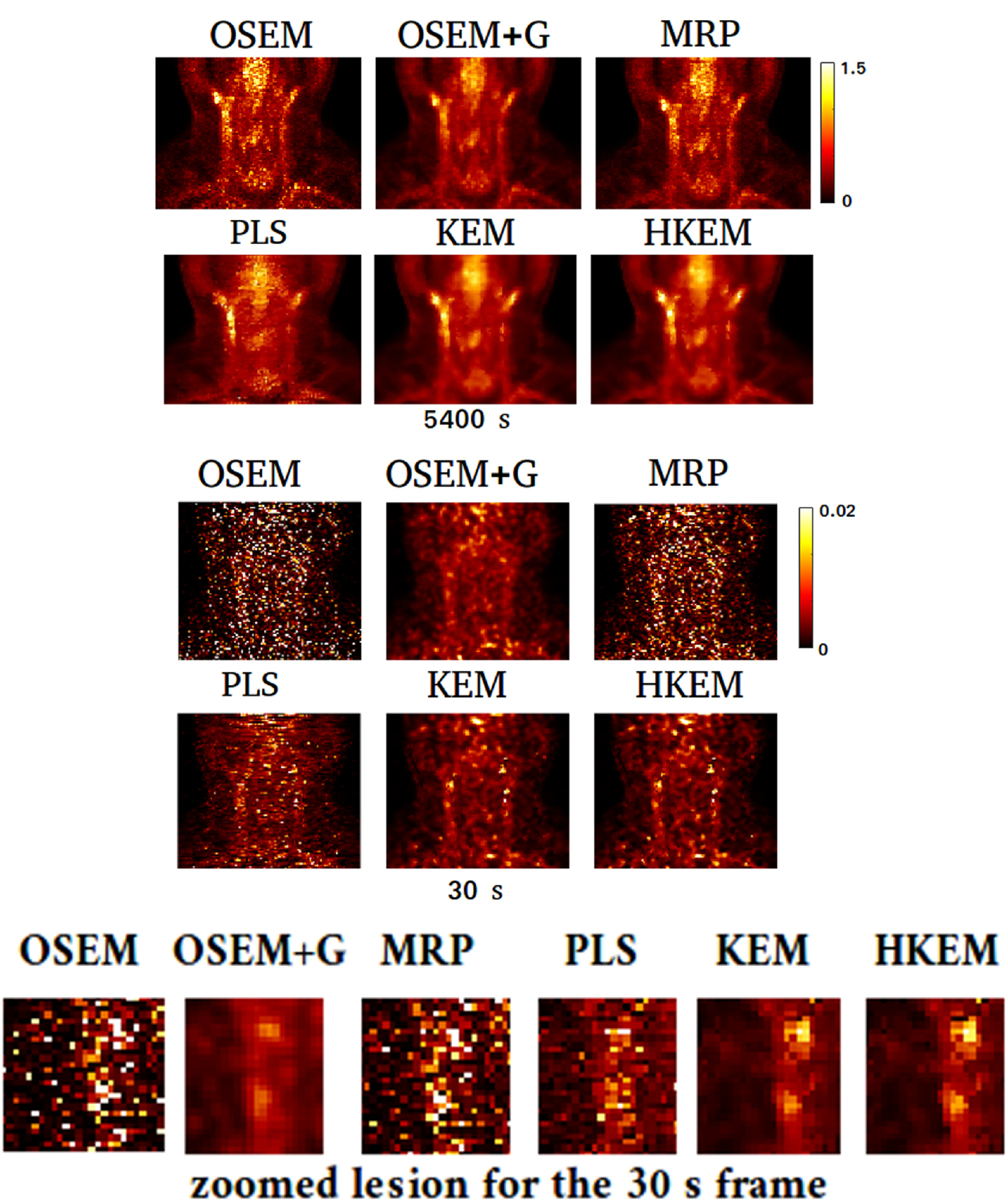 Hybrid PET-MR list-mode kernelized expectation maximization ...