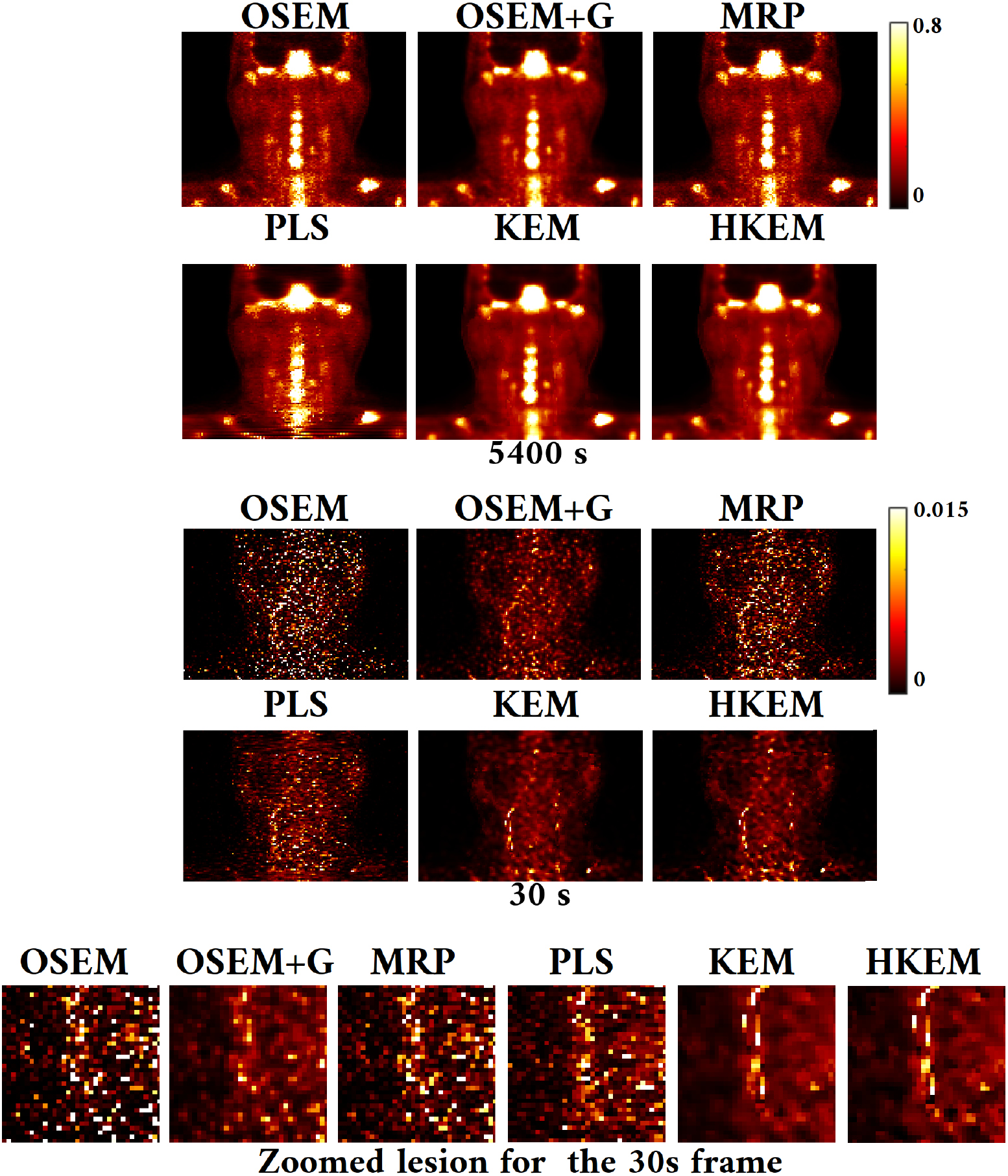 Hybrid PET-MR list-mode kernelized expectation maximization ...