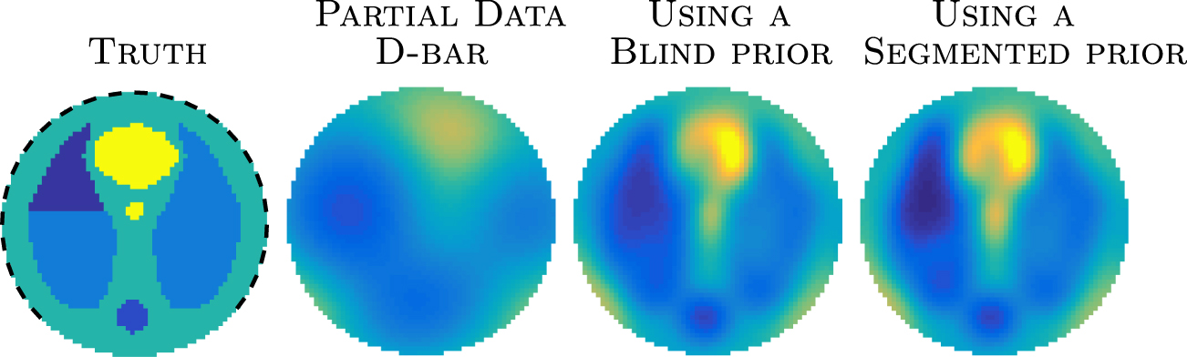 The D-bar method for electrical impedance tomography—demystified ...