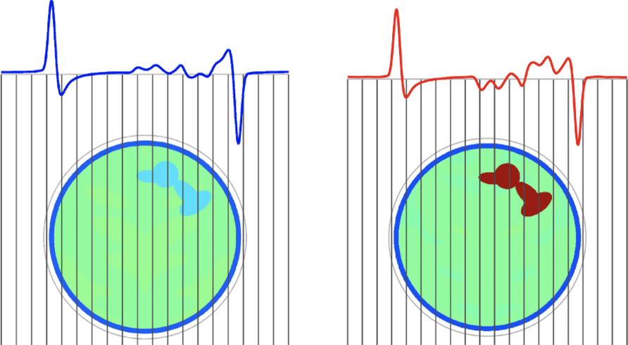 The D-bar method for electrical impedance tomography—demystified ...