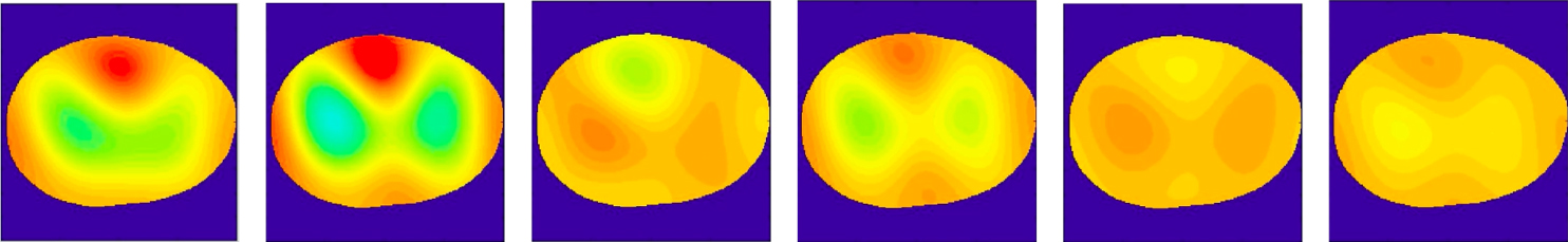The D-bar method for electrical impedance tomography—demystified ...