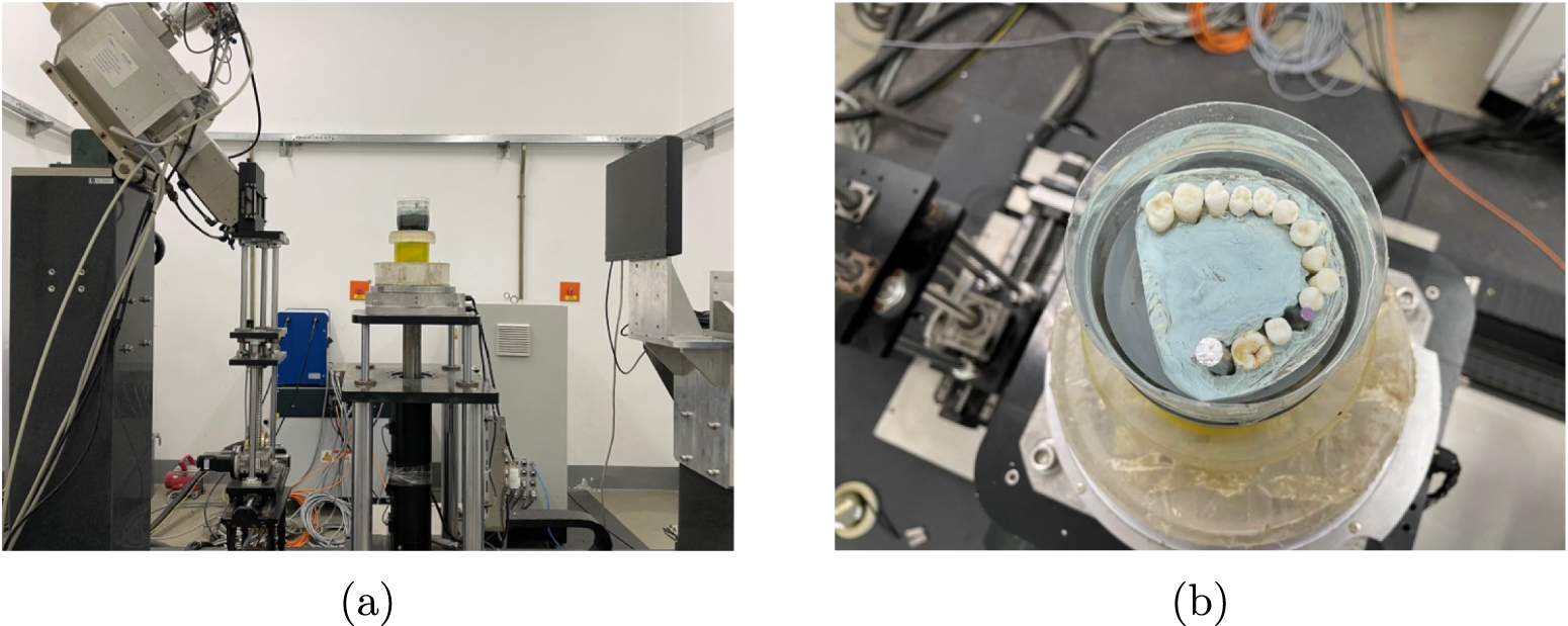 Nonconvex weighted variational metal artifacts removal via convergent ...