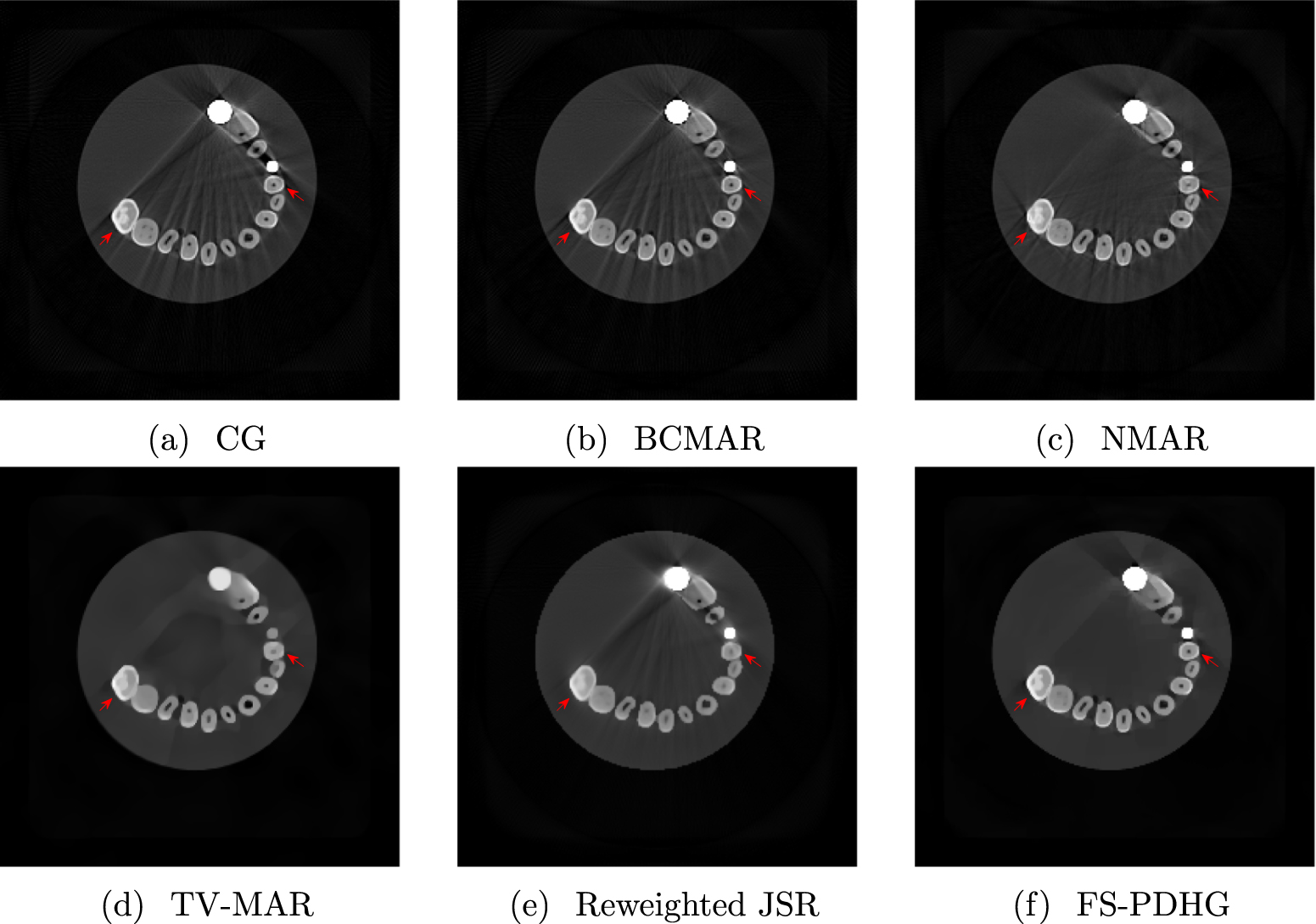 Nonconvex weighted variational metal artifacts removal via convergent ...