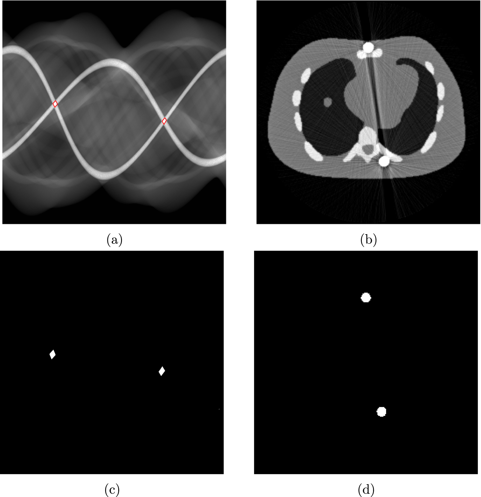 Nonconvex weighted variational metal artifacts removal via convergent ...