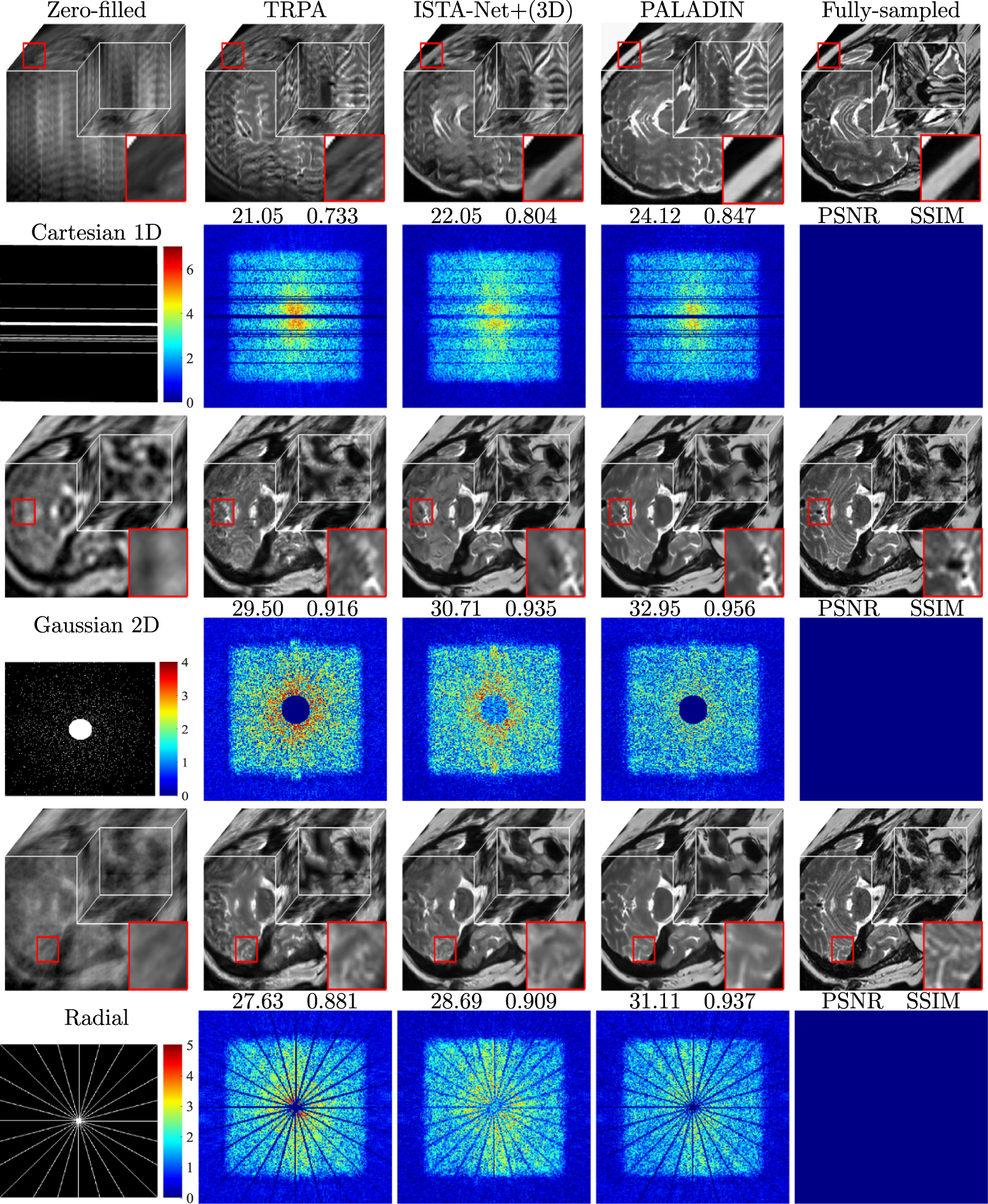 Cs Mri Pattern PALADIN: a novel plug-and-play 3D CS-MRI reconstruction method - IOPscience