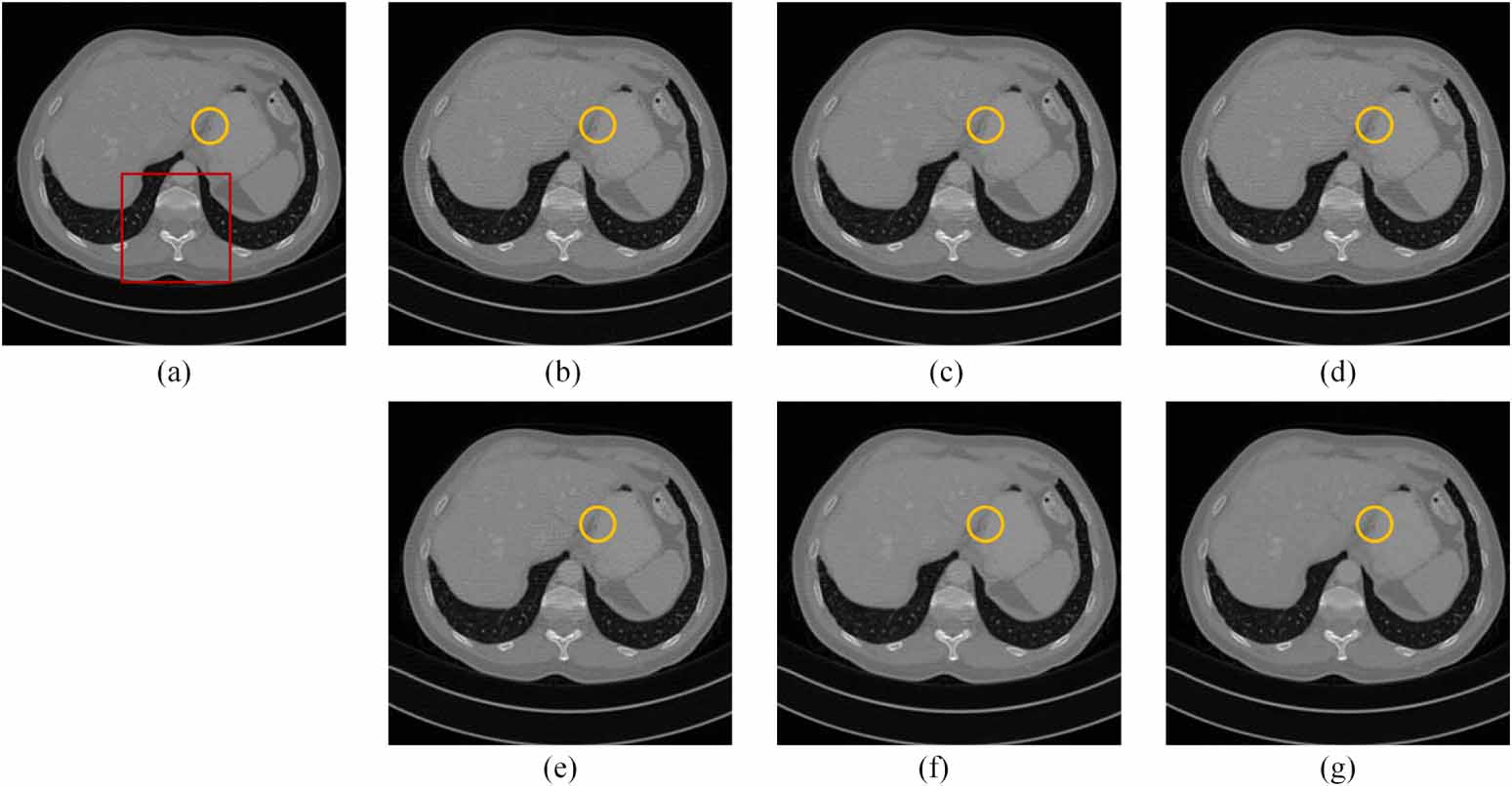 Sparse-view CT reconstruction based on total variation with alternating ...