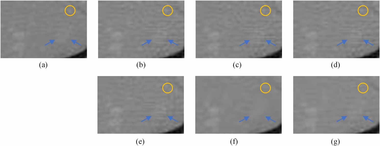 Sparse-view CT reconstruction based on total variation with alternating ...