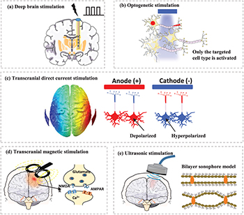 Modulating Neuron Dynamic modeling of neuromodulation techniques: Towards elaboration and ...