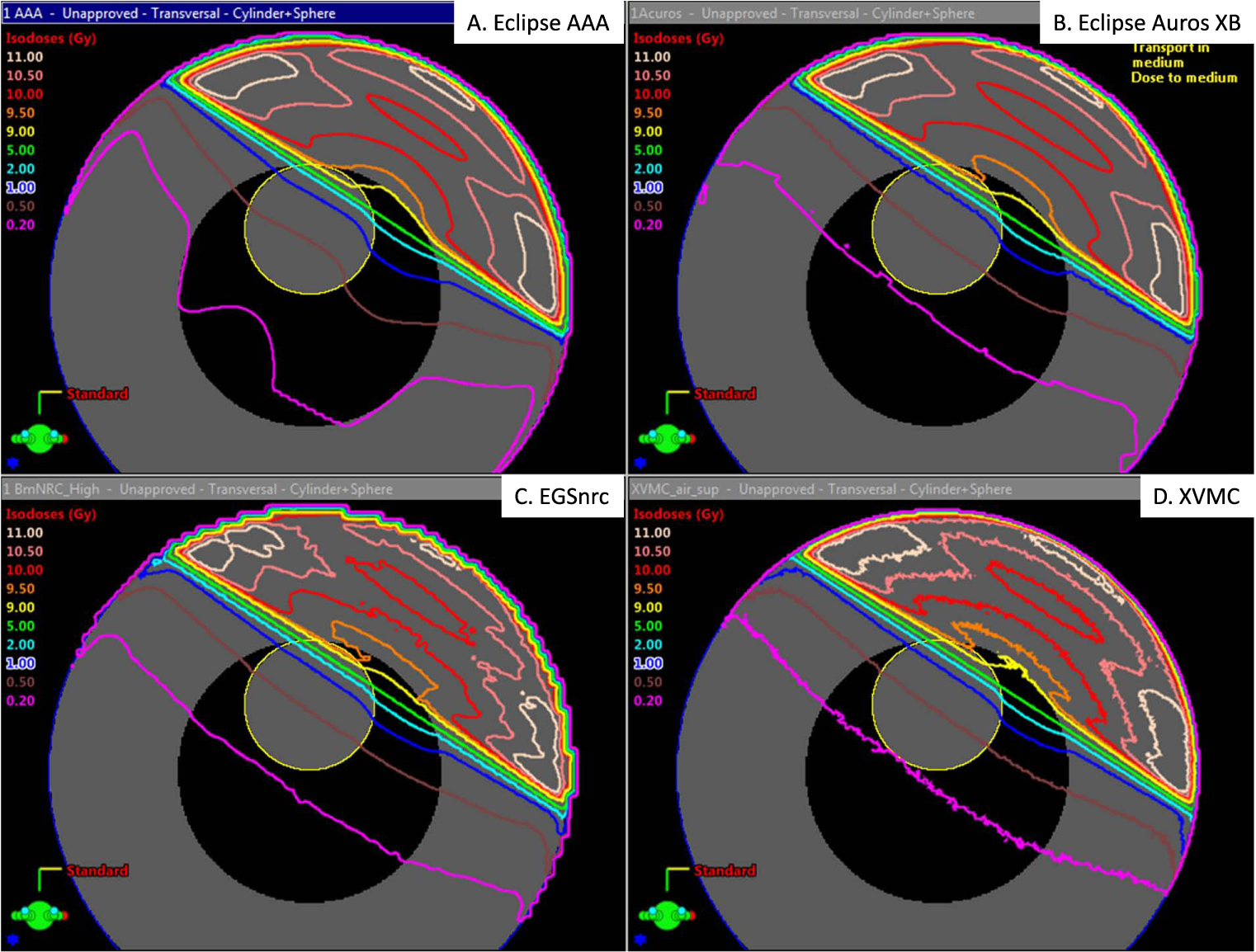 Aaa Dose Calculation Comparison of normal tissue dose calculation methods for ...