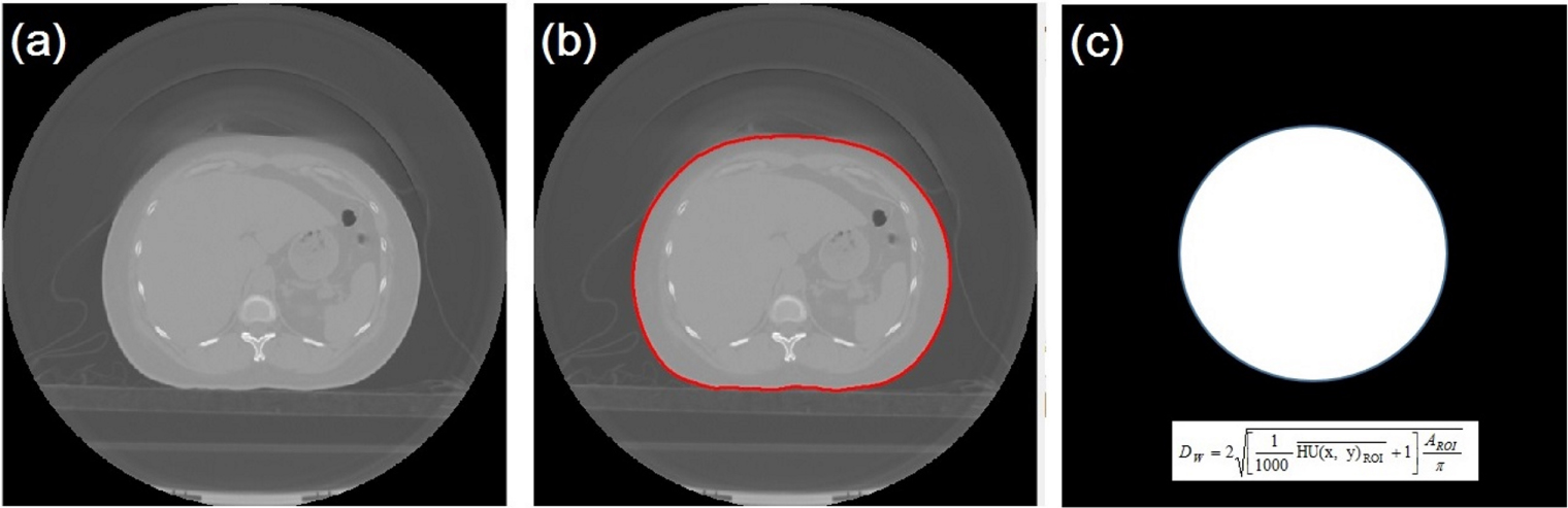 Ccot Radiographic Assessment of patient dose and noise level of clinical CT images ...