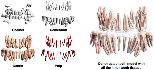 Tooth Pattern Csi Detailed tooth models for ICRP mesh-type reference computational ...