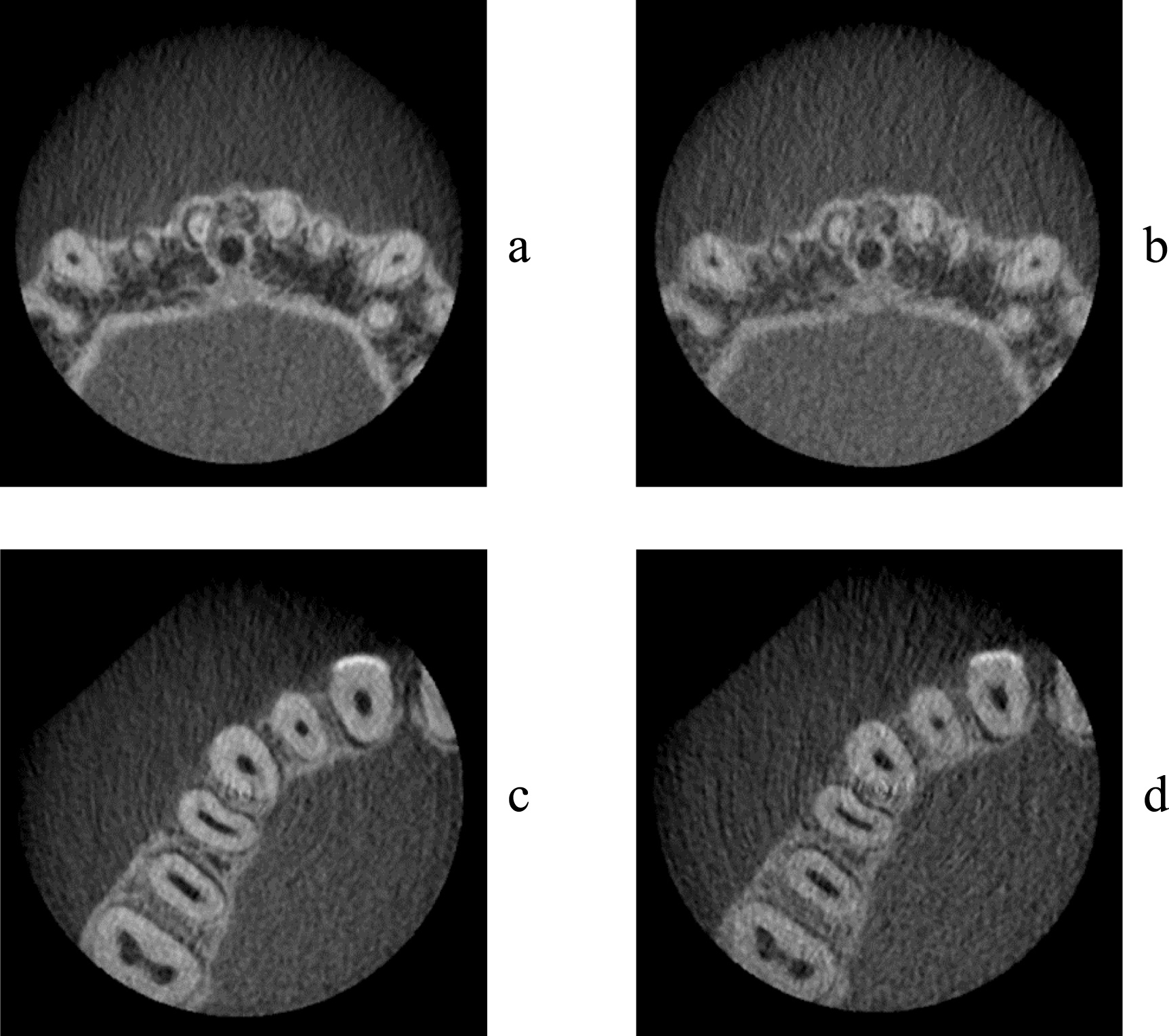Evaluation of radiation dose and image quality for dental cone-beam ...