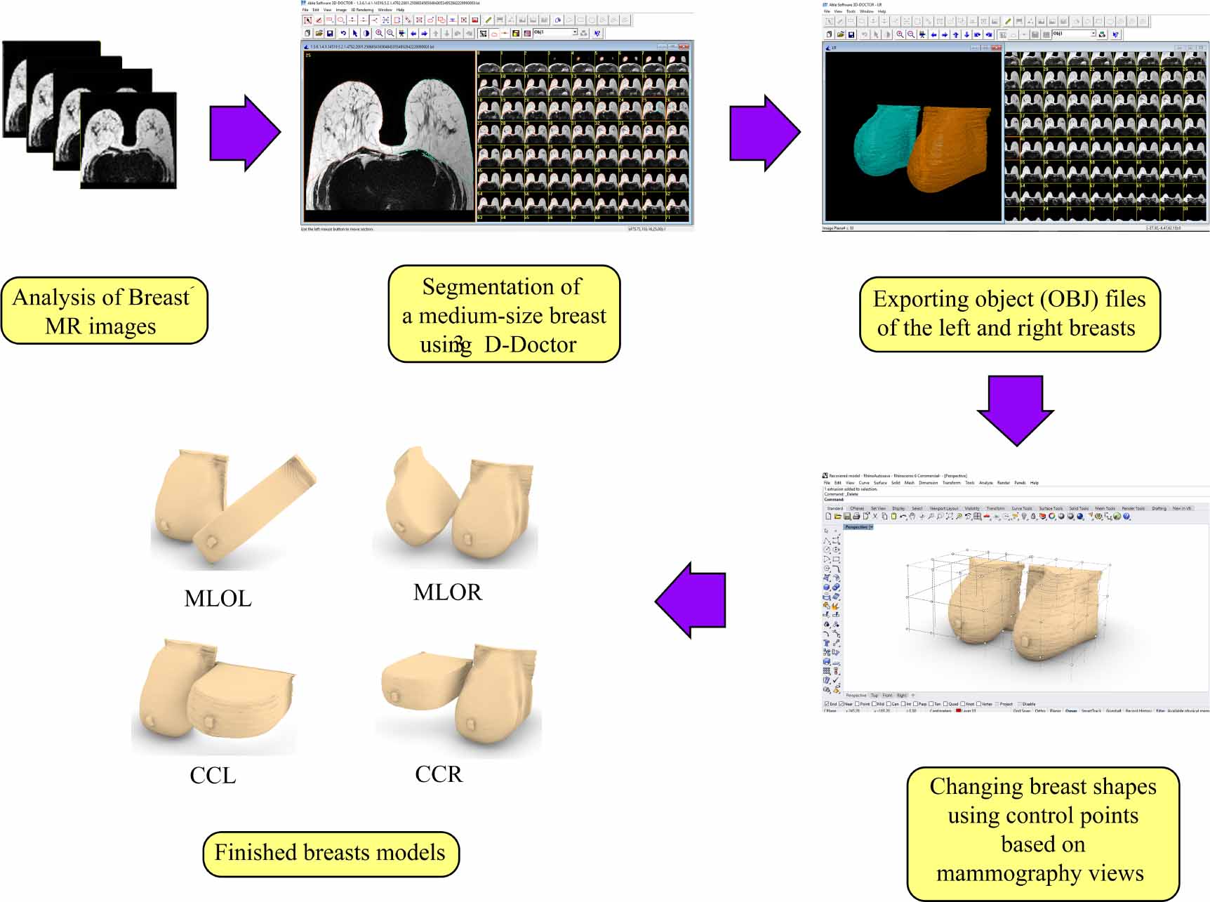 Designing an improved model of the adult female ICRP reference phantom ...