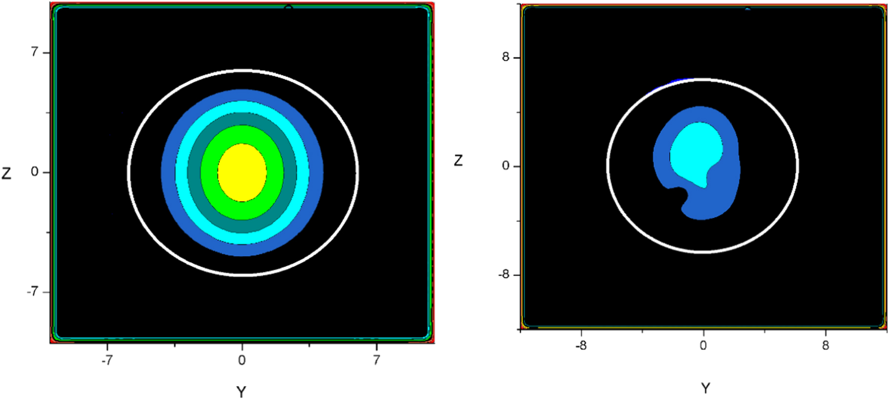 Operating Intermediate State Intermediate state in a type-I superconducting sphere: pinning and size ...