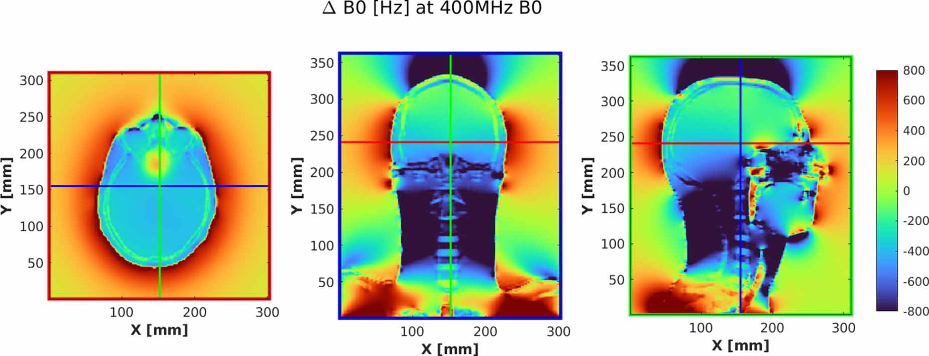 Design requirements for human UHF magnets from the perspective of