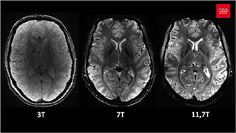 Mri Magnet Image Review on high-temperature superconducting magnet technology for its ...
