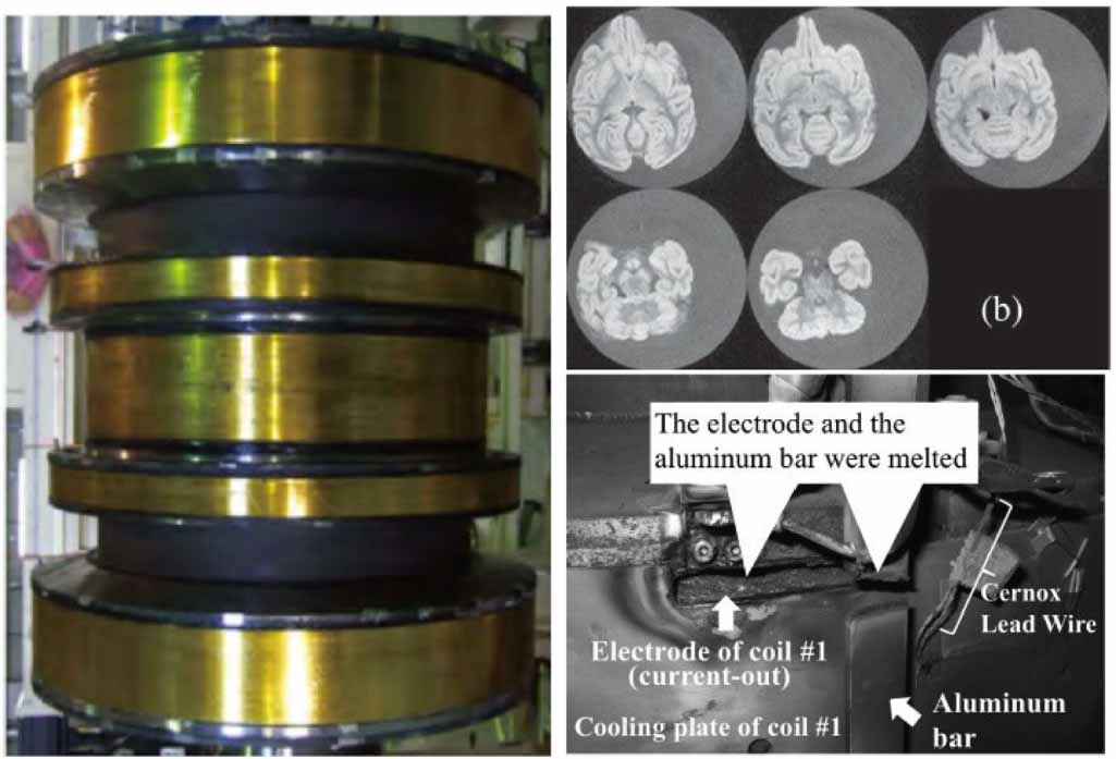 Mri Magnet Image Review on high-temperature superconducting magnet technology for its ...
