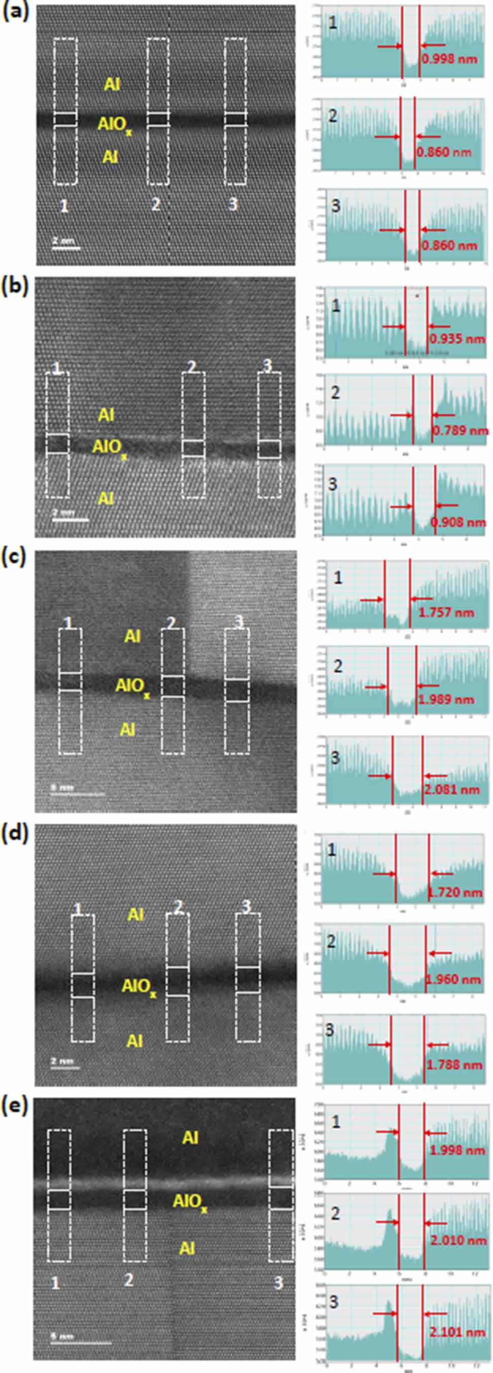 Alox Pattern Crystalline upper and lower aluminum layers in Al/AlOx/Al tri-layer ...