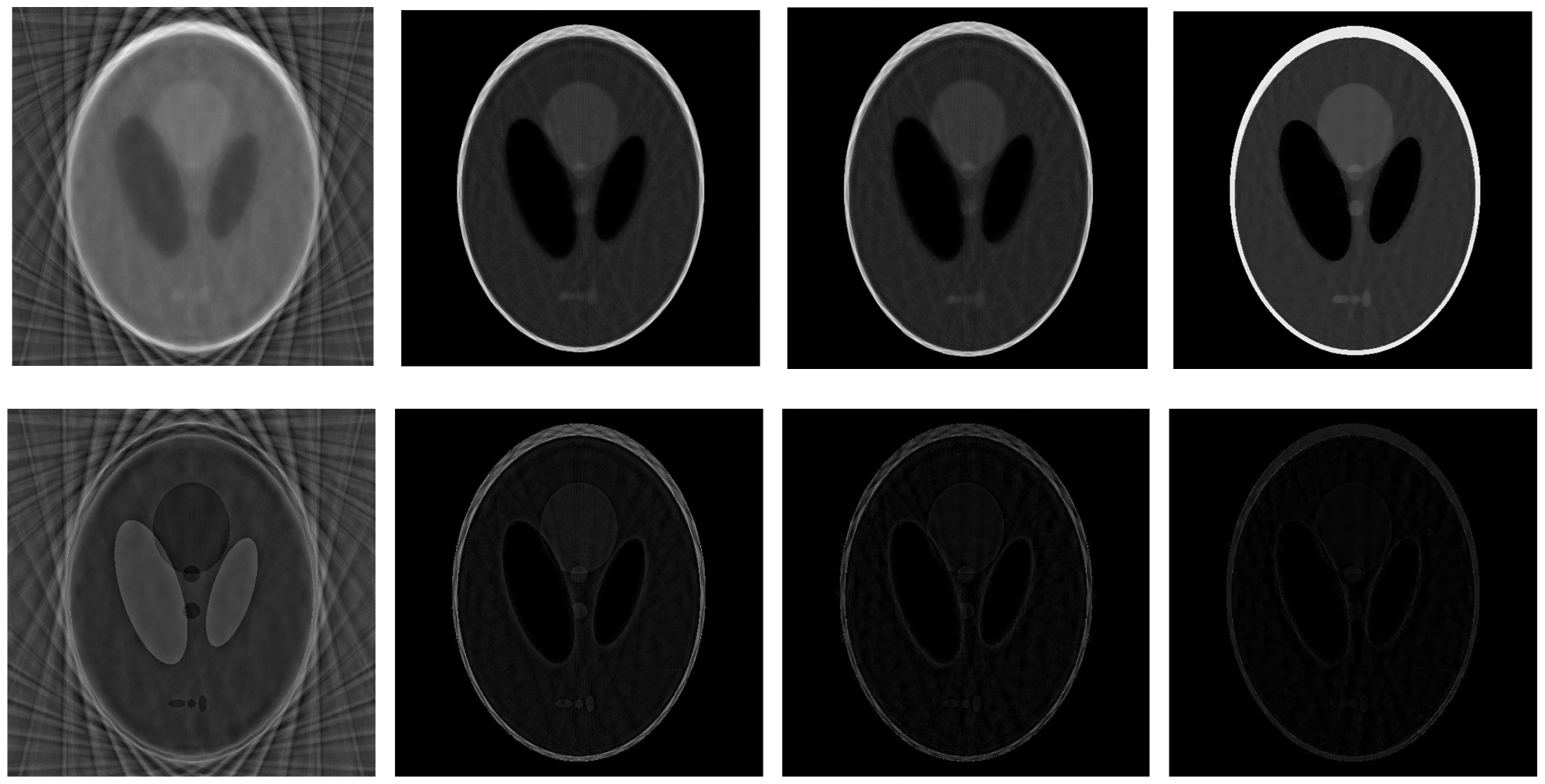 Sparse-view CT reconstruction based on gradient directional total ...