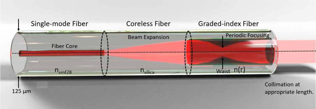 Design considerations for graded index fiber tip Fabry–Perot ...