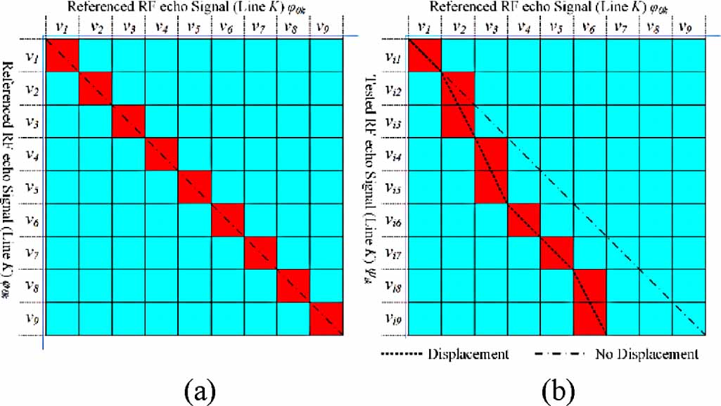 A fast and quantitative measurement of shear wave speed and attenuation ...