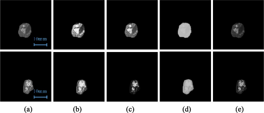 Adaptive image enhancement and particle size identification