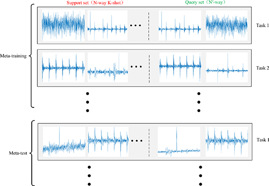 A new meta-transfer learning method with freezing operation for few ...