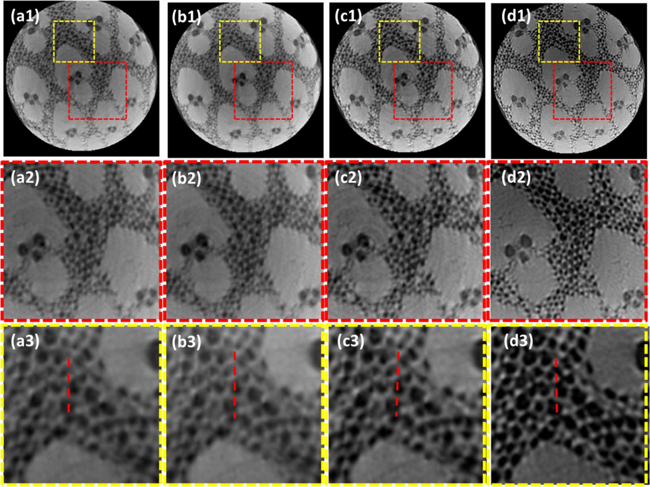 Micro Ct Resolution Super-resolution model-based iterative reconstruction for lens-coupled ...