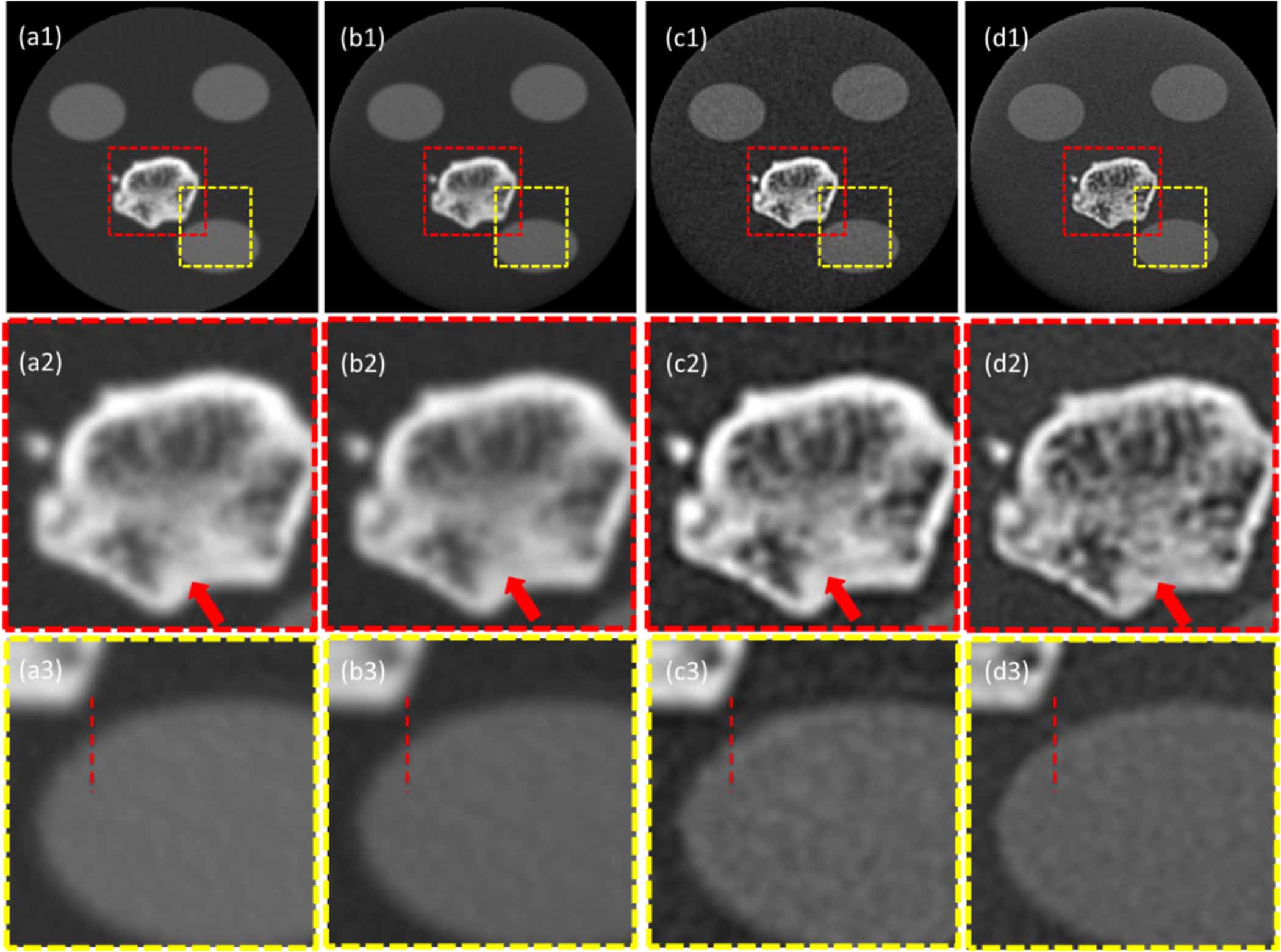 Micro Ct Resolution Super-resolution model-based iterative reconstruction for lens-coupled ...