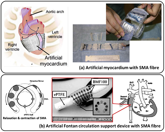 Exploring the potential of 3D printing for shape memory alloys: a ...