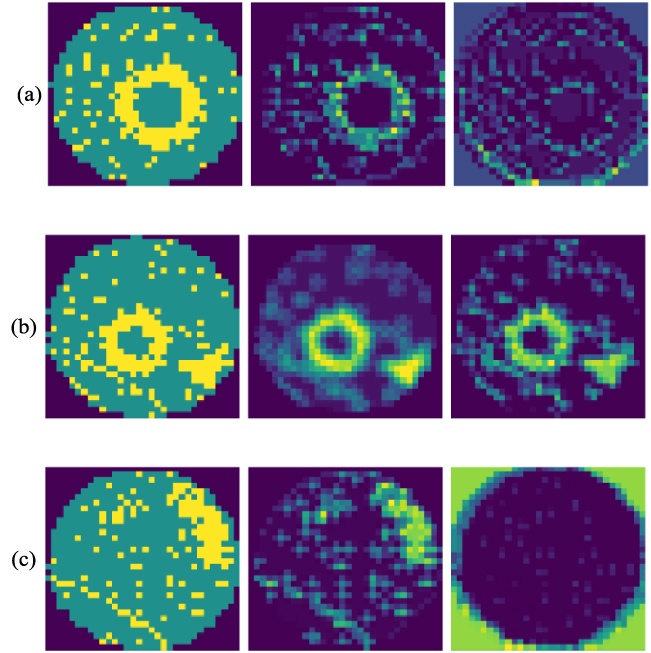 Wafer defect pattern recognition based on differentiable architecture ...