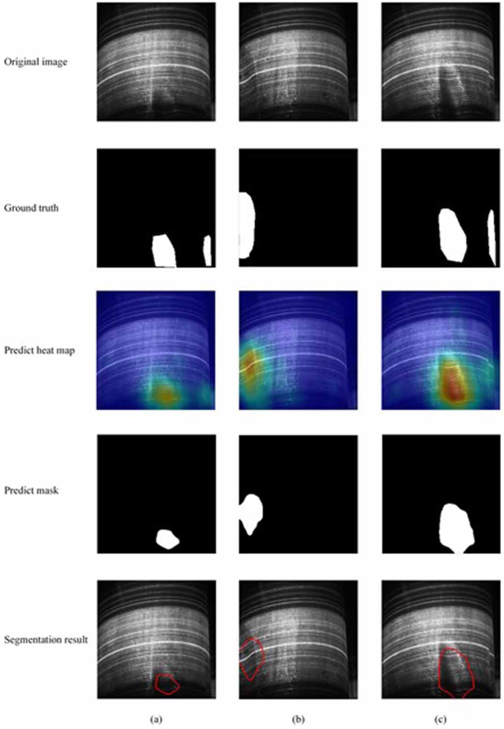 Outer surface defect detection of steel pipes with 3D vision based on ...