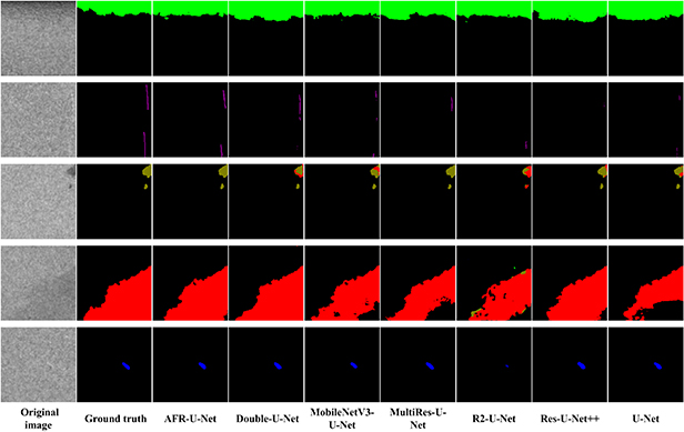 An adaptive feature refinement network for pixel-level segmentation of ...