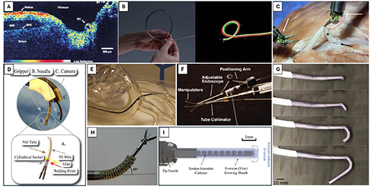 Extraluminal Device Examples Medical & healthcare robotics: a roadmap for enhanced precision, safety ...