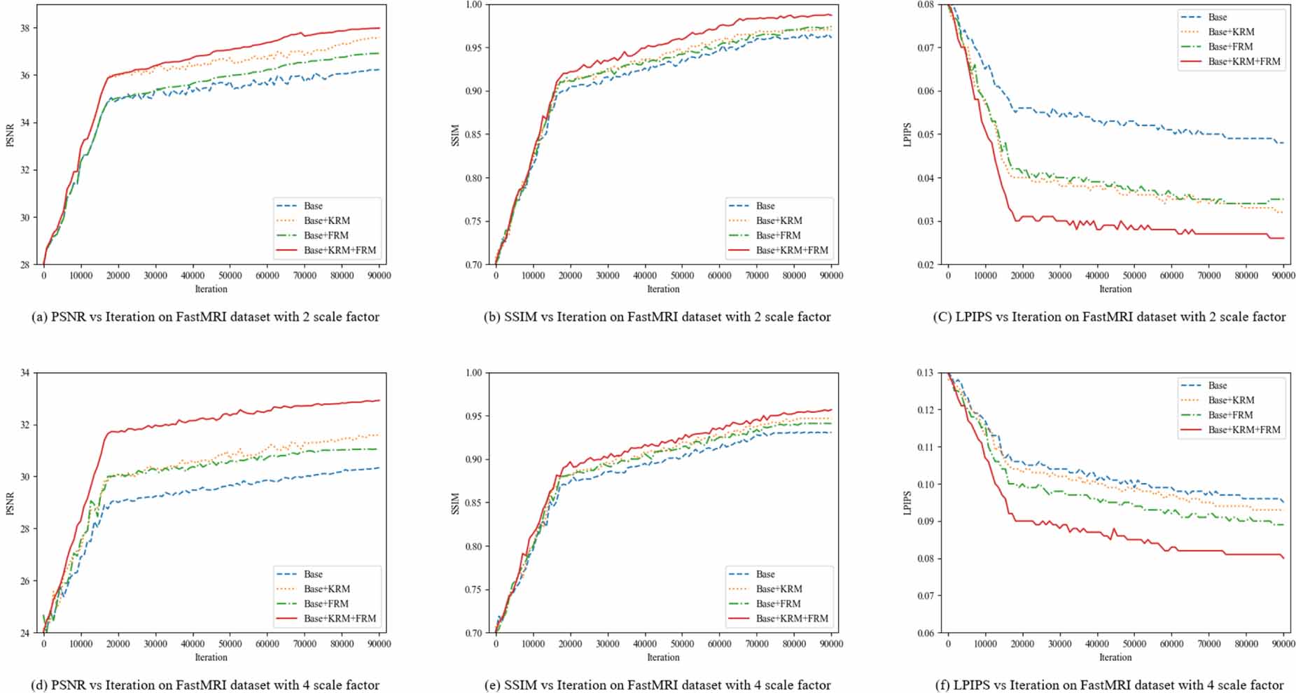 Kernel-aware network with dual diffusion model for MRI blind super  resolution - IOPscience