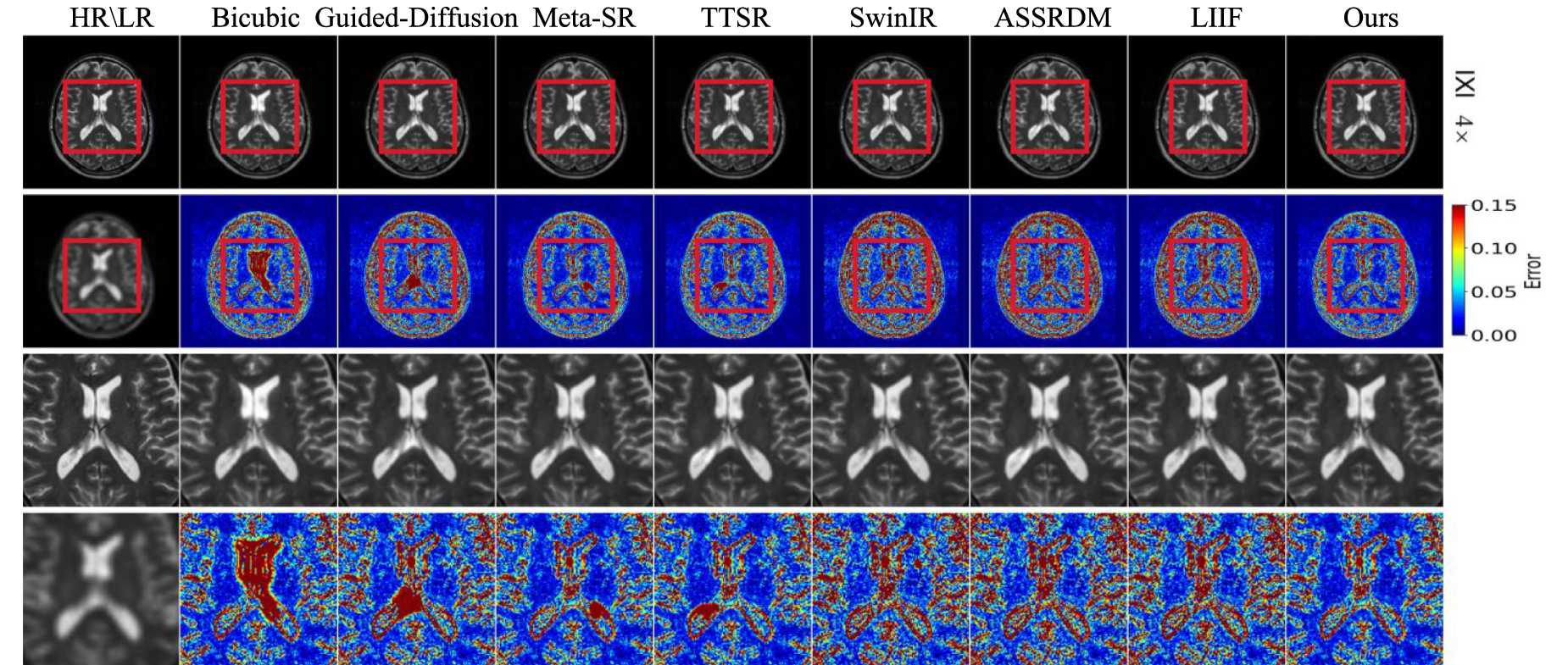 Kernel-aware network with dual diffusion model for MRI blind super ...